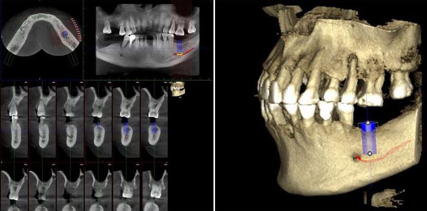 cone beam ct scanner